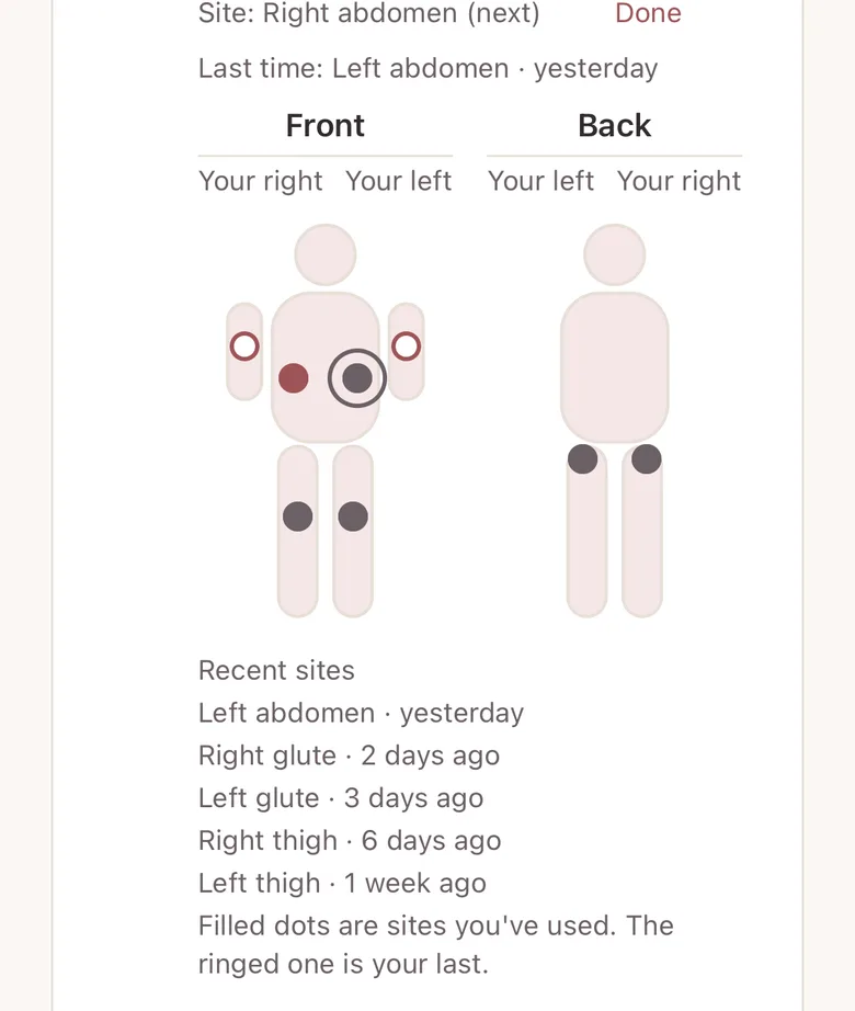 MyLane's injection-site diagram, front and back, with the next site marked and a list of recent sites and when each was used